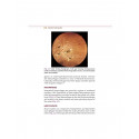 Diabetic Retinopathy from Glycemia to Retina (PB 2027) book by Vikas Ambiya - Additional Image 7