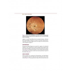 Diabetic Retinopathy from Glycemia to Retina (PB 2027) book by Vikas Ambiya - Additional Image 7