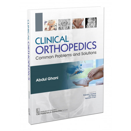 Clinical Orthopedics Common Problems and Solutions (PB 2026) book by Abdul Ghani