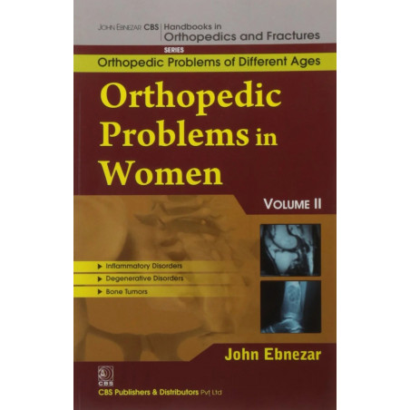 ORTHOPEDIC PROBLEMS IN WOMEN, VOL. II (HANDBOOKS IN ORTHOPEDICS AND FRACTURES SERIES, VOL. 80 -ORTHOPEDIC PROBLEMS OF DIFFER…