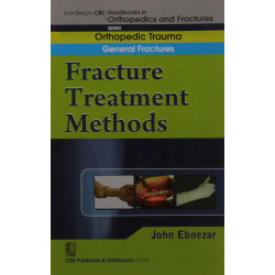 FRACTURE TREATMENT METHODS (HANDBOOK IN ORTHOPEDICS AND FRACTURES VOL 02 ORTHOPEDIC TRAUMA GENERAL FRACTURES (2012): Orthope…