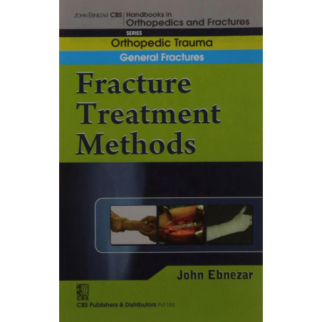 FRACTURE TREATMENT METHODS (HANDBOOK IN ORTHOPEDICS AND FRACTURES VOL 02 ORTHOPEDIC TRAUMA GENERAL FRACTURES (2012): Orthope…