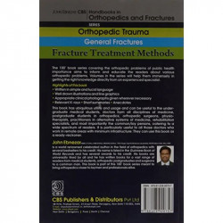 FRACTURE TREATMENT METHODS (HANDBOOK IN ORTHOPEDICS AND FRACTURES VOL 02 ORTHOPEDIC TRAUMA GENERAL FRACTURES (2012): Orthope… -