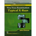 TYPICAL X-RAYS (HANDBOOKS IN ORTHOPEDICS AND FRACTURES SERIES, VOL. 65-PRACTICAL EXAMINATION) book by EBNEZAR J.