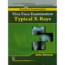 TYPICAL X-RAYS (HANDBOOKS IN ORTHOPEDICS AND FRACTURES SERIES, VOL. 65-PRACTICAL EXAMINATION) book by EBNEZAR J.