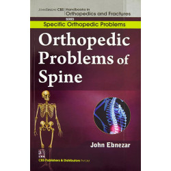 ORTHOPEDIC PROBLEMS OF SPINE (HANDBOOKS IN ORTHOPEDICS AND FRACTURES SERIES VOL 38 SPECIFIC ORTHOPEDIC PROBLEMS (2012): Spec…