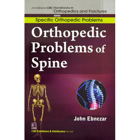 ORTHOPEDIC PROBLEMS OF SPINE (HANDBOOKS IN ORTHOPEDICS AND FRACTURES SERIES VOL 38 SPECIFIC ORTHOPEDIC PROBLEMS (2012): Spec…