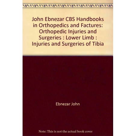 INJURIES AND SURGERIES OF TIBIA (HANDBOOKS IN ORTHOPEDICS AND FRACTURES SERIES, VOL. 57: ORTHOPEDIC INJURIES AND SURGERIES L…