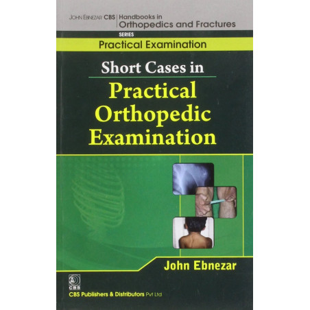 Short Cases In Practical Orthopedic Examination (Handbooks In Orthopedics and Fractures Series, Vol. 64- Practical Examinati…