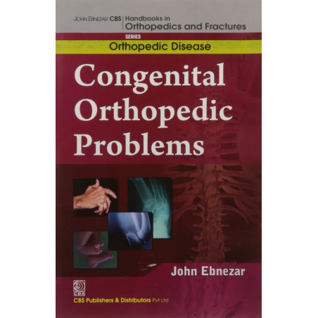 CONGENITAL ORTHOPEDIC PROBLEMS (HANDBOOKS IN ORTHOPEDICS AND FRACTURES SERIES VOL 28 ORTHOPEDIC DISEASE) A (2012) book by EB…