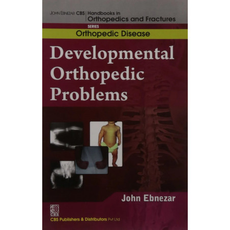 Developmental Orthopedic Problems (Handbooks In Orthopedics and Fractures Series, Vol. 29: Orthopedic Disease) book by EBNEZ…