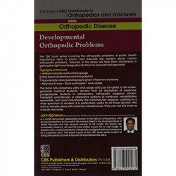 Developmental Orthopedic Problems (Handbooks In Orthopedics and Fractures Series, Vol. 29: Orthopedic Disease) book by EBNEZ… -
