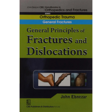 GENERAL PRINCIPLES OF FRACTURES AND DISLOCATIONS (HANDBOOK OF ORTHOPEDICS AND FRACTURES SERIES VOL 1 ORTHOPEDIC TRAUMA GENER…