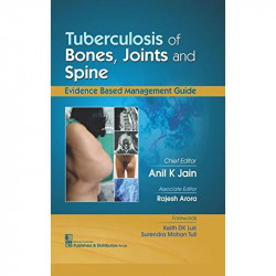 TUBERCULOSIS OF BONES JOINTS AND SPINE (HB 2017) book by JAIN A K