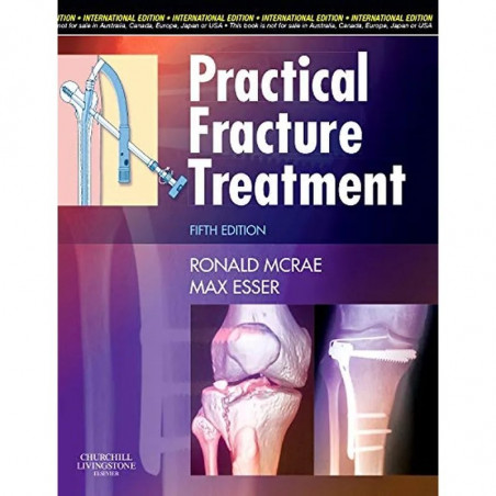 Practical Fracture Treatment, International Edition book by McRae
