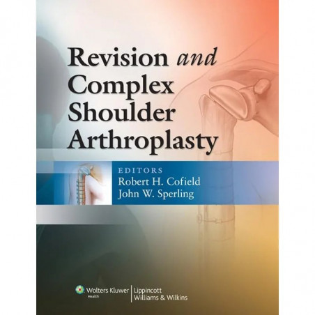 Revision and Complex Shoulder Arthroplasty book by Robert H. Cofield, John W. Sperling