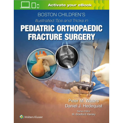 BOSTON CHILDRENS ILLUSTRATED TIPS AND TRICKS IN PEDIATRIC ORTHOPAEDIC FRACTURE SURGERY (HB 2020) book by WATERS P M