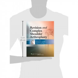 Revision and Complex Shoulder Arthroplasty book by Robert H. Cofield, John W. Sperling - Additional Image 3