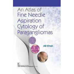An Atlas of Fine Needle Aspiration Cytology of Paragangliomas book by AR Khan