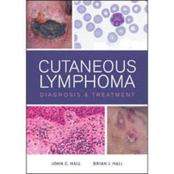 Cutaneous Lymphoma Diagnosis and Treatment book by John C. Hall, Brian Hall
