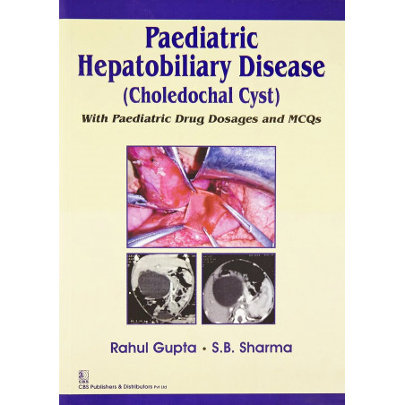 PAEDIATRIC HEPATOBILIARY DISEASE (CHOLEDOCHAL CYST) WITH PAEDIATRIC DRUG DOSAGES AND MCQS (PB-2015) book by GUPTA R.