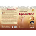 PRACTICE OF LIPOSUCTION (HB 2024) book by Anup Dhir - Additional Image 3