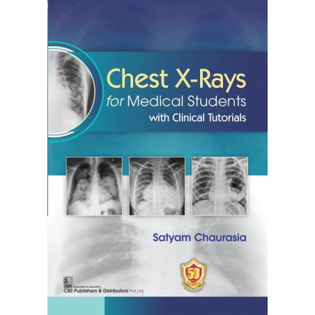 Chest X Rays For Medical Students With Clinical Tutorials (Pb 2025) book by SATYAM CHAURASIA