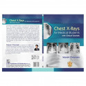 Chest X Rays For Medical Students With Clinical Tutorials (Pb 2025) book by SATYAM CHAURASIA - Additional Image 4