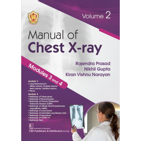Manual Of Chest Xray Modules 3 And 4 Vol 2 (Pb 2025) book by Rajendra Prasad, Nikhil Gupta