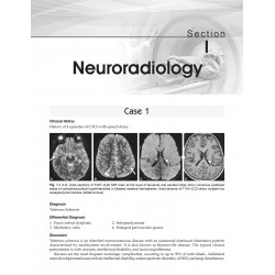 Companion for Radiology Residents | • Read • Recognise • Report (PB 2026) book by Rajoo Ramachandran, Rajeswaran Rangasami - Add