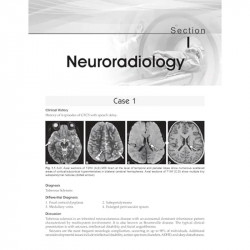 Companion for Radiology Residents | • Read • Recognise • Report (PB 2026) book by Rajoo Ramachandran, Rajeswaran Rangasami - Add