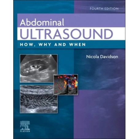ABDOMINAL ULTRASOUND: HOW, WHY AND WHEN 4TH EDITION book by Nicola Davidson