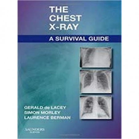 The Chest X-Ray: A Survival Guide, 1e book by DE LACEY G