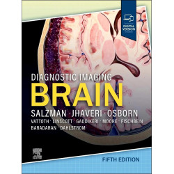 Diagnostic Imaging Brain book by Miral D. Jhaveri, Karen L. Salzman