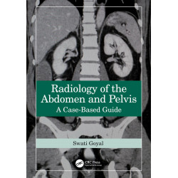 Radiology of the Abdomen and Pelvis: A Case-Based Guide book by Swati Goyal