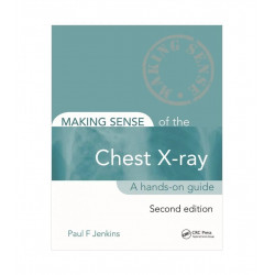 MAKING SENSE OF THE CHEST X-RAY A HANDS ON GUIDE 2ED (PB 2020) book by JENKINS P.F.