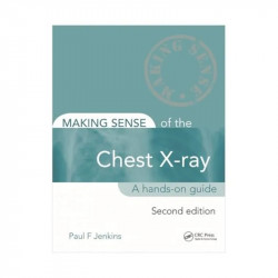 MAKING SENSE OF THE CHEST X-RAY A HANDS ON GUIDE 2ED (PB 2020) book by JENKINS P.F. - Back Cover