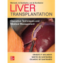 Liver Transplantation: Operative Techniques and Medical Management book by Ernesto P. Molmenti, Martin de Santibañes