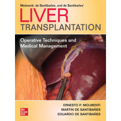 Liver Transplantation: Operative Techniques and Medical Management book by Ernesto P. Molmenti, Martin de Santibañes