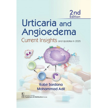 URTICARIA AND ANGIOEDEMA CURRENT INSIGHTS AND UPDATES IN 2025 2ED (HB 2026) book by Kabir Sardana, Mohammad Adil