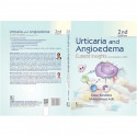 URTICARIA AND ANGIOEDEMA CURRENT INSIGHTS AND UPDATES IN 2025 2ED (HB 2026) book by Kabir Sardana, Mohammad Adil - Additional Im