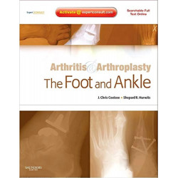 ARTHRITIS AND ARTHROPLASTY: THE FOOT AND ANKLE: EXPERT CONSULT - ONLINE, PRINT AND DVD book by Coetzee