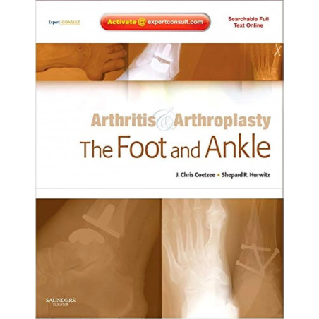 ARTHRITIS AND ARTHROPLASTY: THE FOOT AND ANKLE: EXPERT CONSULT - ONLINE, PRINT AND DVD book by Coetzee