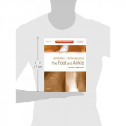 ARTHRITIS AND ARTHROPLASTY: THE FOOT AND ANKLE: EXPERT CONSULT - ONLINE, PRINT AND DVD book by Coetzee - Additional Image 3