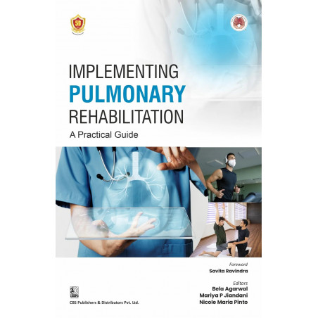 Implementing Pulmonary Rehabilitation A Practical Guide - (PB - 2026) book by Bela Agarwal, Mariya P Jiandani