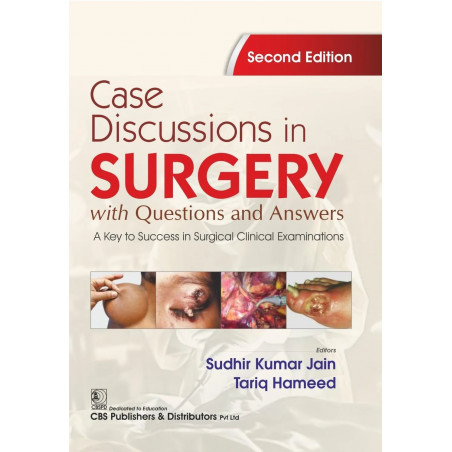 Case Discussions in Surgery with Questions and Answers | A Key to Success in Surgical Clinical Examinations 2ed. | (PB - 202…