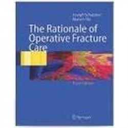 The Rationale Of Operative Fracture Care 3Ed book by Joseph Schatker
