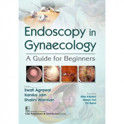 Endoscopy in Gynaecology | A Guide for Beginners ( PB 2025 ) book by Swati Agrawal, Kanika Jain