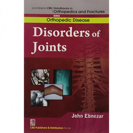 DISORDERS OF JOINTS (HANDBOOKS IN ORTHOPEDICS AND FRACTURES SERIES VOL 32 ORTHOPEDIC DISEASE (2012): Orthopedic Disease: Dis… -
