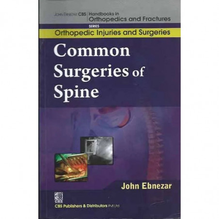 COMMON SURGERIES OF SPINE (HANDBOOKS IN ORTHOPEDICS AND FRACTURES SERIES, VOL. 59-ORTHOPEDIC INJURIES AND SURGERIES) book by…